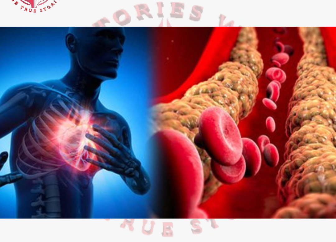 When bad cholesterol starts accumulating in the veins, these measures will get rid of it